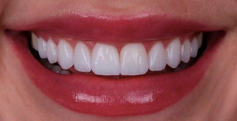 Sorriso em close